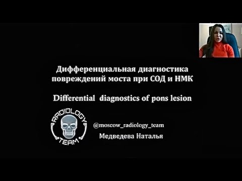 ПОНТИННЫЙ МИЕЛИНОЛИЗ | НЕЙРОВИЗУАЛИЗАЦИЯ |  ЛЕКЦИЯ МРТ | НАТАЛЬЯ МЕДВЕДЕВА | MOSCOW RADIOLOGY TEAM