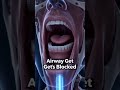 You STOP Breathing While Sleeping 😨  #sleepapnea  #Biology #HumanBody #ScienceShorts #YouTubeShorts