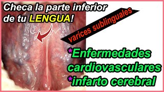 Checa la parte inferior de tu LENGUA ahora mismo! Me darás las gracias 1000 veces