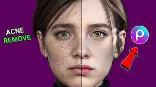 Pimples Gone in 2 Minute! 😲 This PicsArt Secret for Flawless Skin screenshot 1