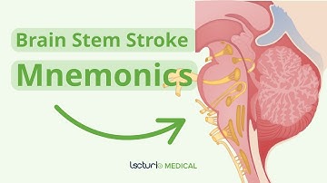 Brain Stem Stroke Mnemonics You Need to Know 🧠