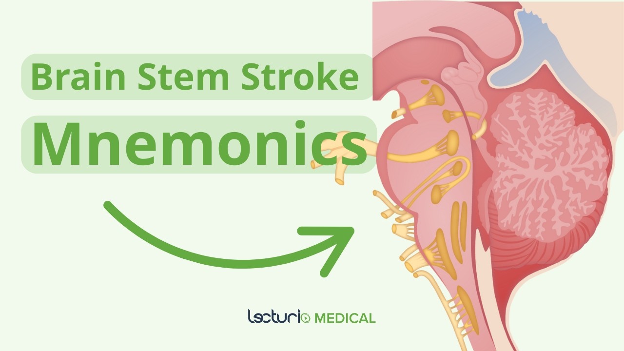 How to Ace Brain Stem Stroke Questions 💡 | USMLE Prep