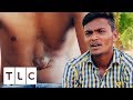 Indian Teenager Lives With His Heart Outside Of His Chest | Body Bizarre