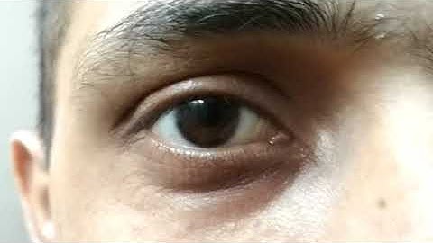 eye mask transition in final cut pro