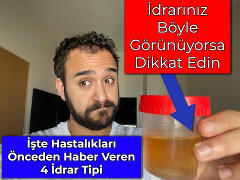 Video: THC Düzeyleri Nasıl Test Edilir: 13 Adım (Resimlerle)