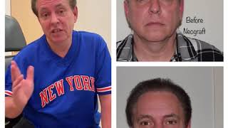NeoGraft Hair Transplant Testimonial | Dr. David P. Rapaport NYC
Patient gives a testimonial following his neograft hair transplant procedure in NYC with board certified plastic surgeon David P. Rapaport, MD.
Contact
Email: info@drrapaport.com
Website: www.ParkAvenuePlasticSurgeon.com
Phone: 212-249-9955 NeoGraft Hair Transplant Testimonial | Dr. David P. Rapaport NYC