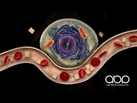Type 1 Diabetes - YouTube