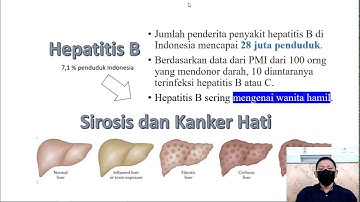 Hepatitis B pada Kehamilan