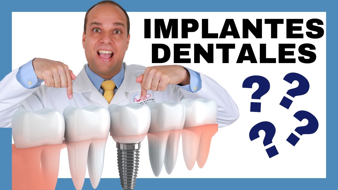 En cuanto tiempo se rechaza un implante dental