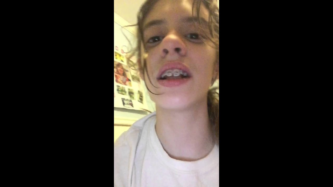 Braces q and a YouTube