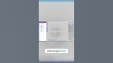 Master Diffraction Data Sets  Spotting Issues Fast