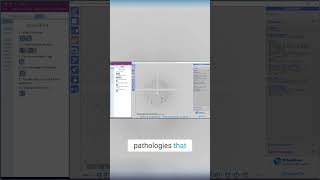 Master Diffraction Data Sets  Spotting Issues Fast