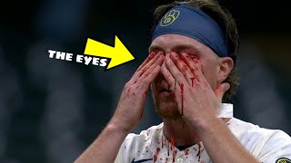 MLB• Worst Injuries 2