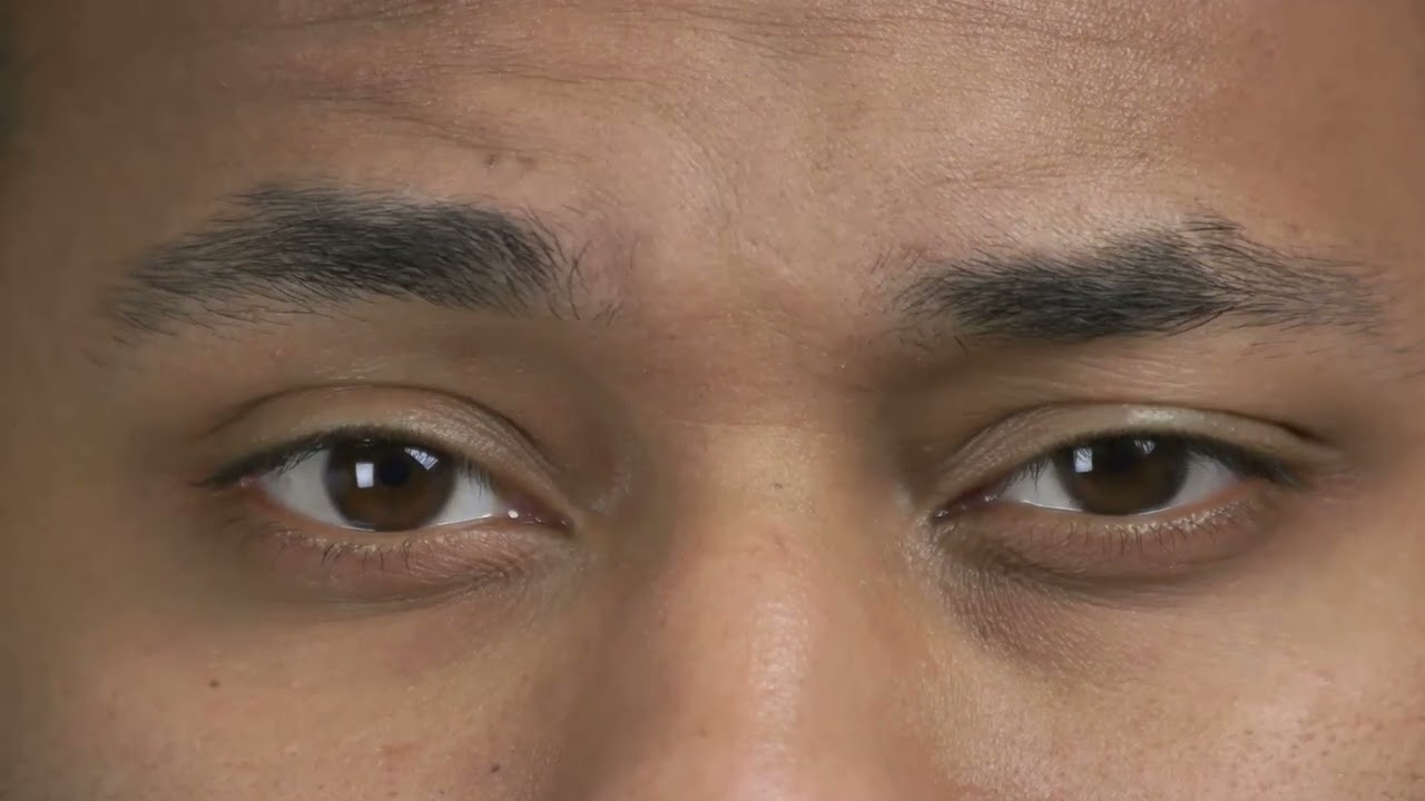 Mangosteen Benefits, Side Effects & More! 