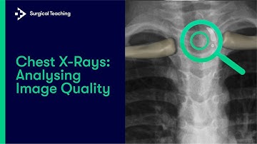 Chest X-Rays: Analysing Image Quality