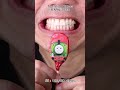 Satisfying Chewing ASMR #Compilation #ASMR #DoctorTristanPeh