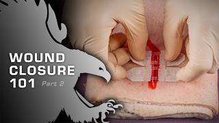 Wound Closure 101 – Learn How to Close a Wound With a Closure Device #woundcare #firstaid #sutures