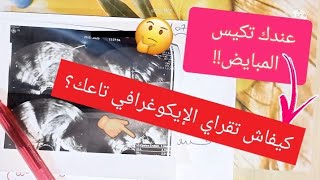 كيفية قراءة السونار المهبلي وتشخيص تكيس المبايض من خلاله