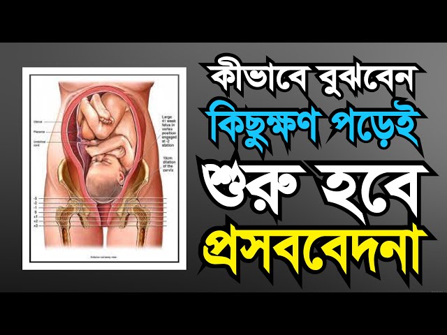 Pushkino, Ivanteevkadagi jinsiy aloqa elonlari Qattiq qaynona