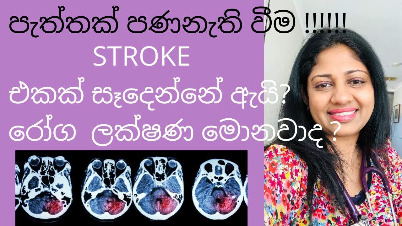 STROKES TYPES SYMPTOMS AND SIGNS RISK FACTORS BLOOM WITH DR MAHEN SRI strokes-types-symptoms-and-signs-risk-factors-bloom-with-dr-mahen-sri