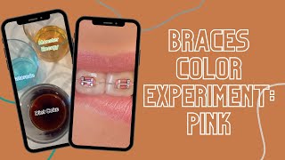 Braces Color Experiment: Pink #shorts