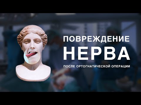 Повреждение нерва после ортогнатической операции