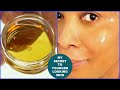 ONLY 3 DROPS AT NIGHT, WAKE UP WITH 18 YEARS YOUNGER SKIN, ANTI -AGING FACE OIL | Khichi Beauty