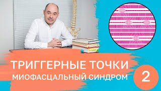 Триггерные точки. Миофасциальный синдром.