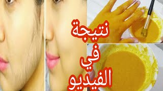 الوصفة المثالية لتخلص من الشعر الزائد في الوجه أو أي منطقة بسهولة ودون عذاب أو ألم