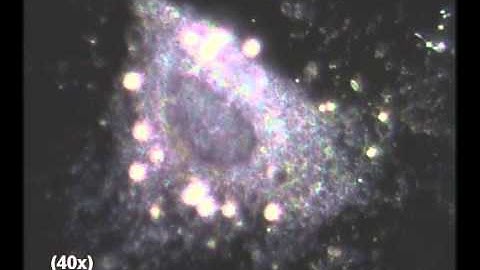 Rickettsia Bacteria Intracellular: Captured Using CytoViva Enhanced Darkfield Microscopy System