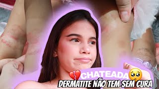 MÃE DE 5: descobrir que minha bebê tem dermatite, vamos precisar tratar