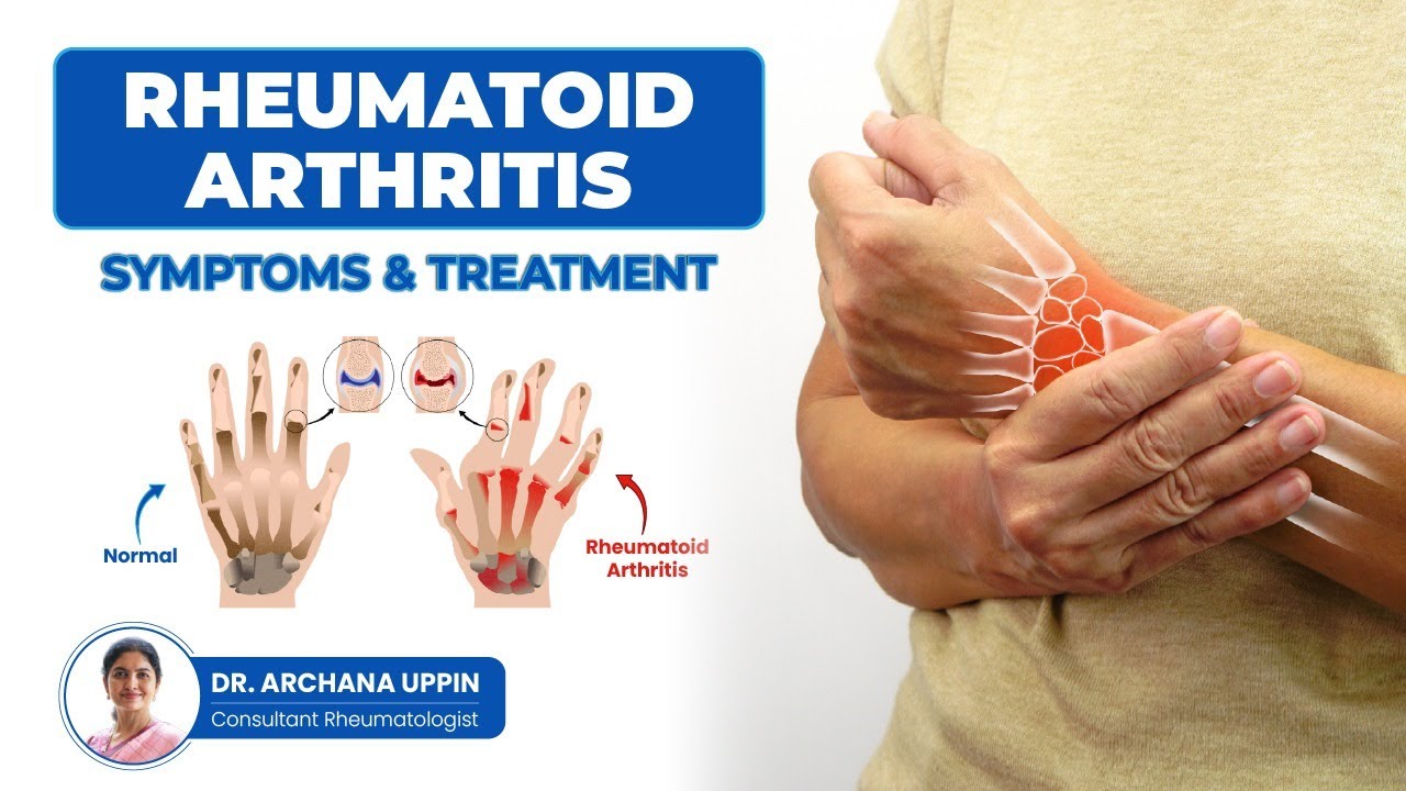 Rheumatoid Arthritis: Symptoms and Treatment | Dr Archana Uppin