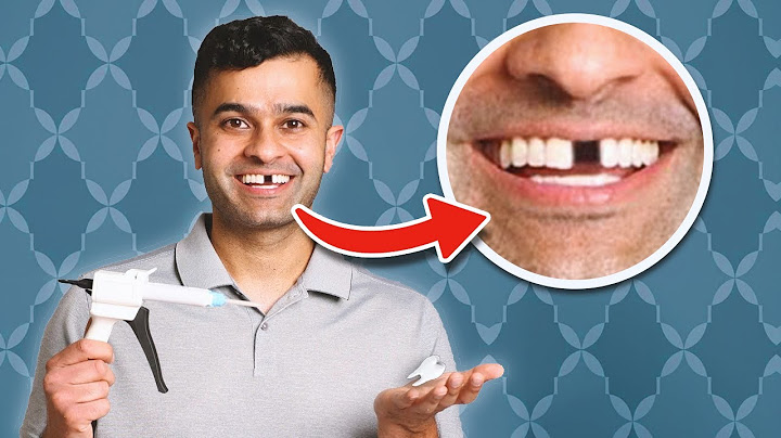 Can you get invisalign with missing back teeth