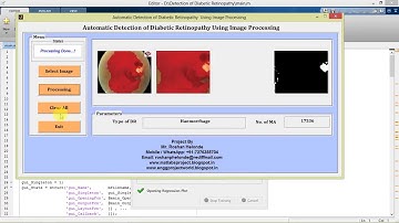 Matlab code for Diabetic Retinopathy Detection using Neural Network IEEE Based Project