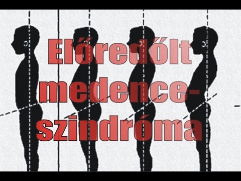 Videó: 3 módszer a medence dőlésének rögzítésére