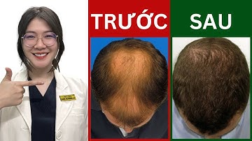 Trị RỤNG TÓC tại nhà hiệu quả - Rụng tóc bệnh lý là gì? | Thạc sĩ - Bác sĩ Phương Quý