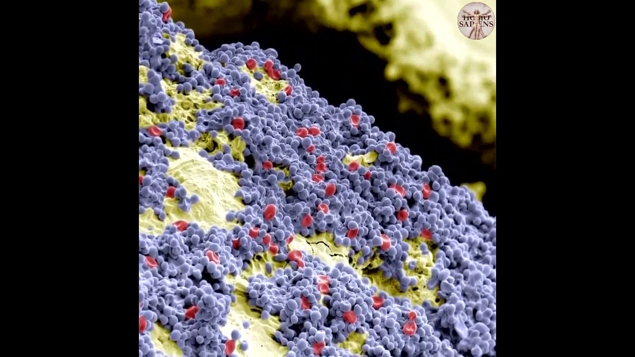 Зубной налет под микроскопом - YouTube
