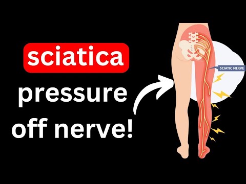 ⚡️ Sciatica Relief⚡️- How To Take Pressure Off The Nerve