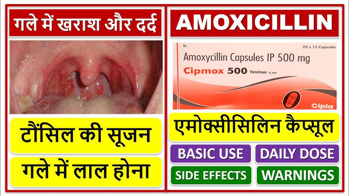 Xylomox Cv 625 Tablet Uses Edu svet gob gt xylomox-cv-625-tablet-uses-edu-svet-gob-gt