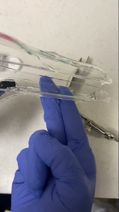 Pap smear