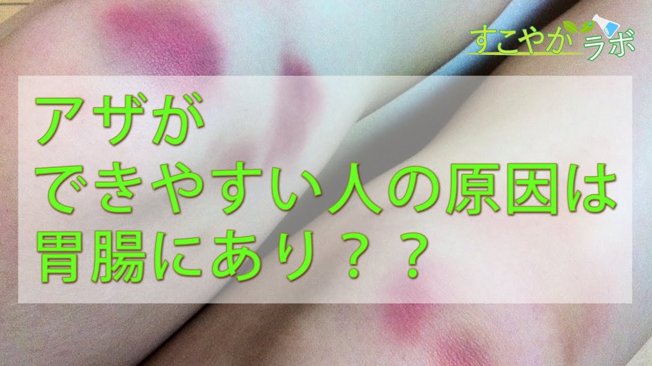 アザができやすい人の原因は胃腸にあり 皮下出血の解決方法 Youtube アザができやすい人の原因は胃腸にあり 皮下出血の解決方法 Youtube
