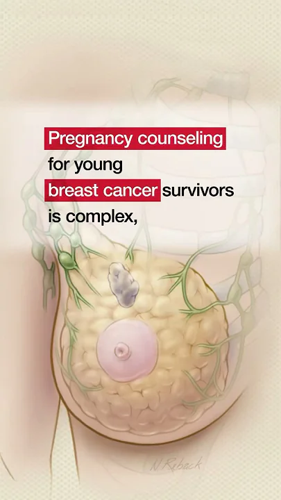 Pregnancy After Breast Cancer in Young BRCA Carriers #shorts