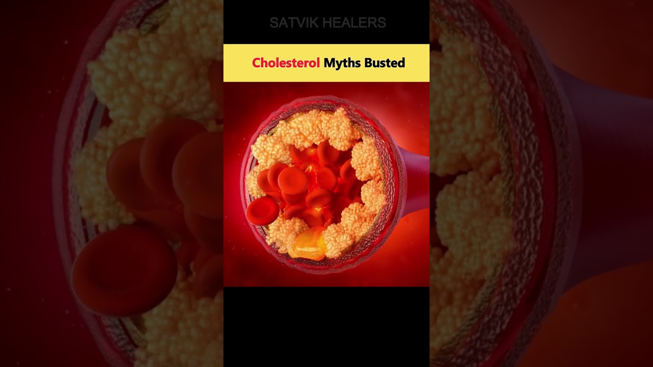 Cholesterol Myths Busted | High Cholesterol Ka Sach | Natural Healing Without Statins