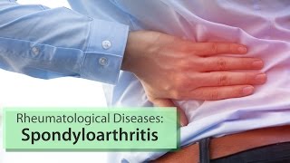 Rheumatological Diseases: Spondyloarthritis