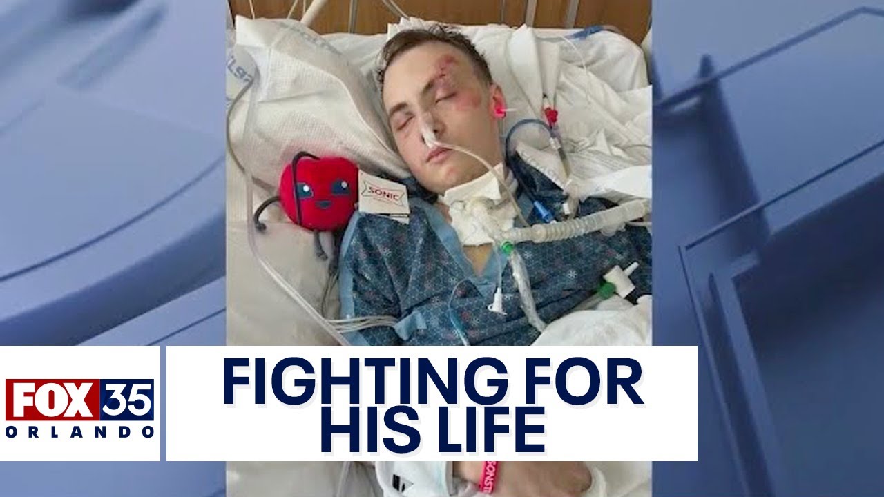 UCF student fighting for his life after getting hit by car while on the ...