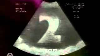 Motion Graphics Bbc 2 Birth Night Ident 1993