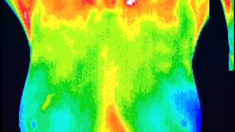 Ingrid LaVasseur Thermography