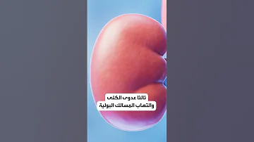 أسباب ألم البطن من الجانب الأيسر 