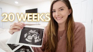 20 WEEK PREGNANCY UPDATE + ANATOMY SCAN RESULTS 👶🏼💕✨ | KAYLA BUELL