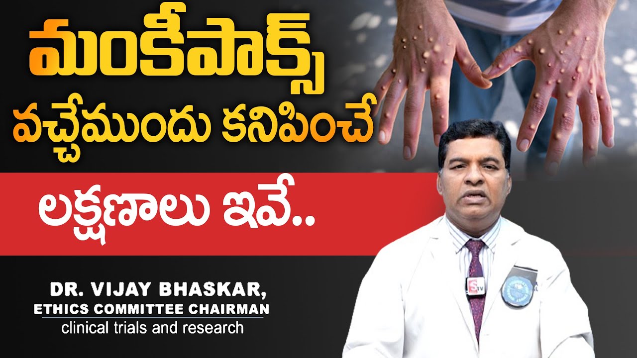 Dr.VijayBhaskar About MonkeyPox Symptoms | Monkeypox Virus Outbreak in India | WHO Issues High Alert